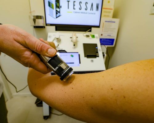 TELEEXPERTISE DERMATOLOGIQUE